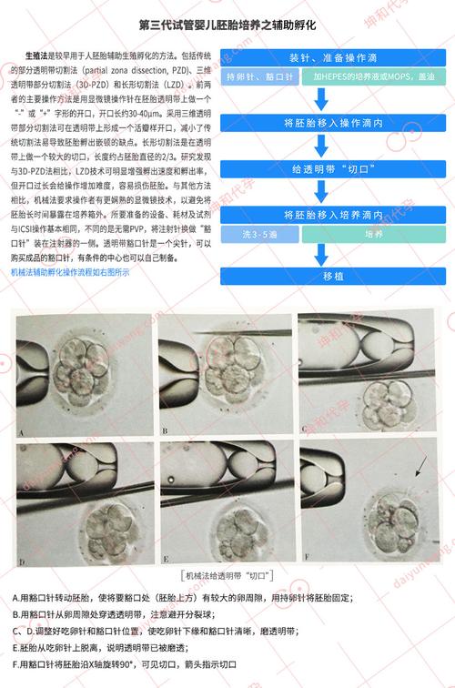 试管供卵试管代怀明细-试管供卵与试管代怀:全面明细解析